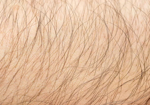 Saçlı Insan Derisinin Dokusu Kapat — Stok fotoğraf