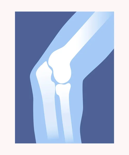 Xray 개념입니다 팔꿈치 팔뼈가 해부학 포스터 학자를 골격이요 현대의 일러스트 — 스톡 벡터