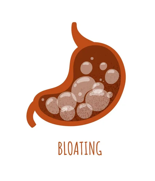胃の概念を膨潤させる 腸内のガス泡 医学情報学 解剖学 生物学 症候群と病気の内臓 漫画フラットベクトルイラスト — ストックベクタ