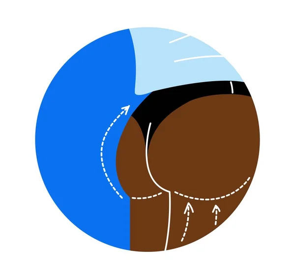 Plastic Surgery Icon Concept Butt Reshaping Liposuction Fat Removal Lift — стоковый вектор
