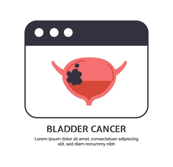 Type Cancer Bladder Concept Disease Iternal Organ Medical Infographics Biology — Stock Vector