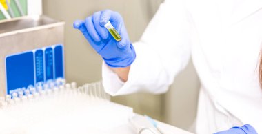 Laboratuvar vitriniyle test tüpü tutan genç bilim kadını bilim laboratuarı araştırma ve geliştirme konsepti, laboratuvar araştırmaları. 