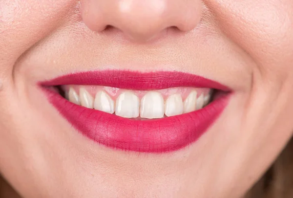 Cara Mulher Feliz Com Sorriso Bonito Dentes Brancos Fotografia Estúdio — Fotografia de Stock