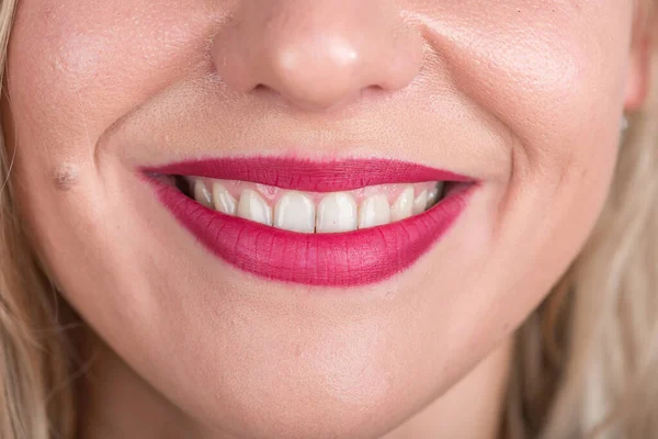 Cara Mujer Feliz Con Sonrisa Bonita Dientes Blancos Studio Photo —  Fotos de Stock
