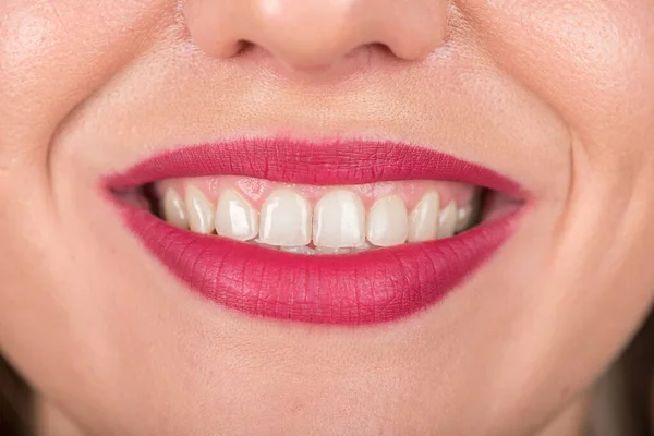 Open Mouth Woman Face Pretty Smile White Teeth Utilisez Rouge — Photo