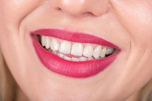 Счастливая Женщина Открытым Ртом Яркая Красная Помада Использовании Белые Зубы — стоковое фото