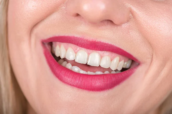Femme Visage Avec Rire Dents Blanches Rouge Lèvres Rouge Cours — Photo