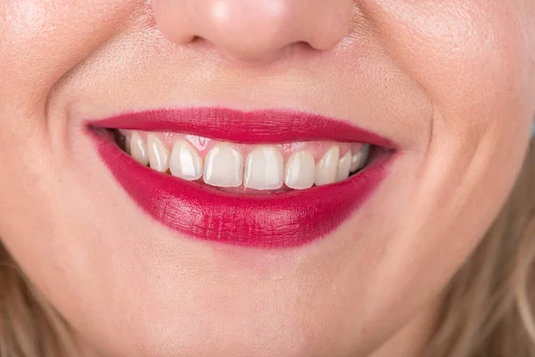 Amplia Sonrisa Mujer Cara Labios Rojos Dientes Blancos Estudio Sesión —  Fotos de Stock