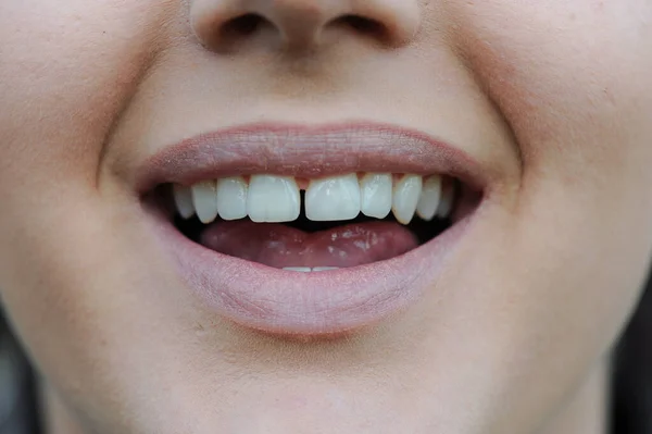 Νεαρό Ενήλικο Πρόσωπο Και Χείλη Ανοικτό Στόμα — Φωτογραφία Αρχείου