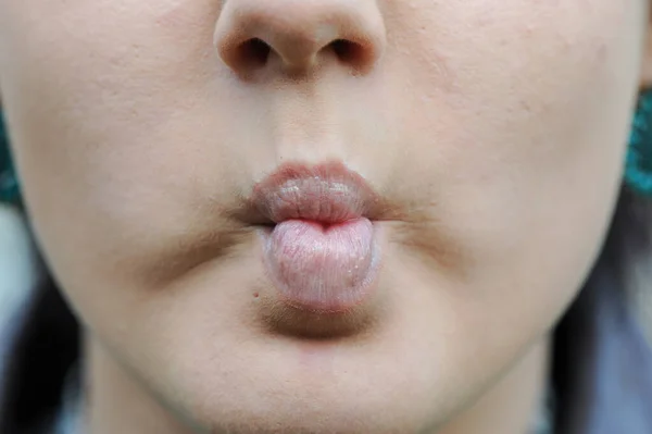 年轻的青少年脸和嘴唇 有趣的唇 — 图库照片