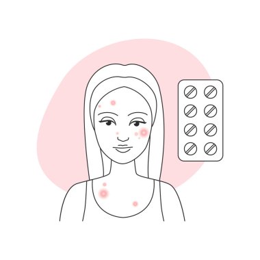 Yüzünde sivilce derisi olan üzgün genç bir kadın ve sivilce tedavisi için su toplayan haplar.