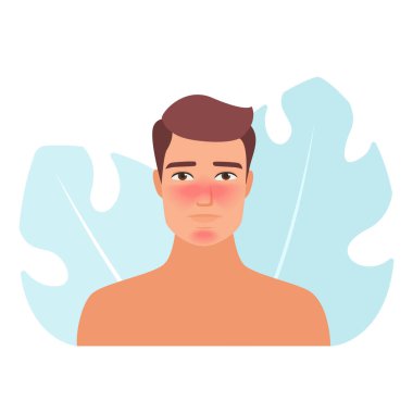 Rosacea ve kızarıklığı olan bir adamın tasviri. Cilt sorunu vektör kavramı.