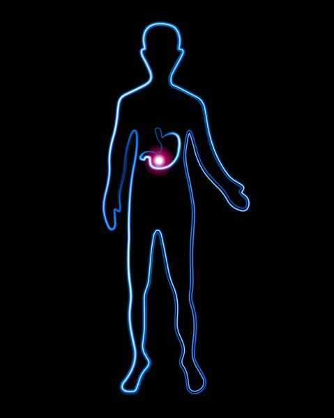 Vektor Izolované Ilustrace Osoby Žaludeční Příznaky Lokalizace Žaludečních Potíží Nemoci — Stockový vektor