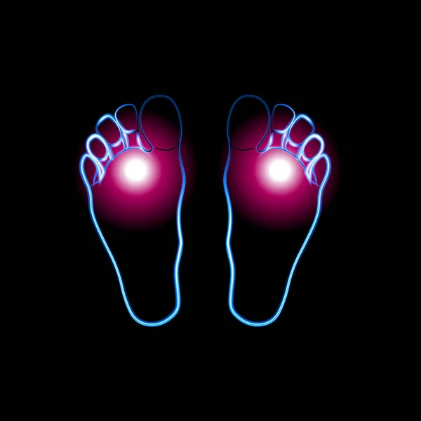 Vektor Isolerad Illustration Mänskliga Fötter Med Neon Effekt Fotsvamp Kliande — Stock vektor