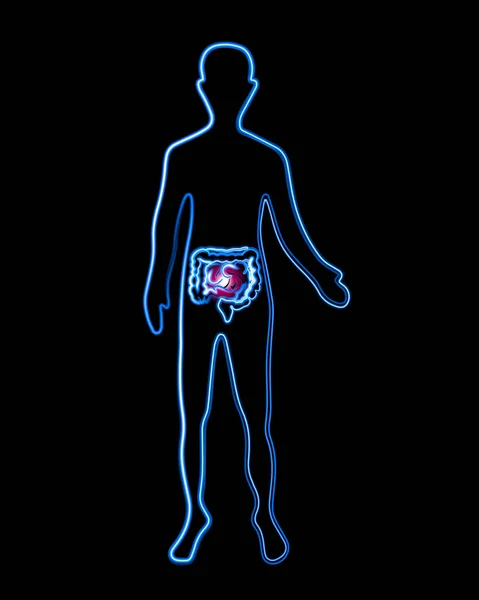 Ilustración Aislada Vectorial Humano Con Marcaje Intestinal Enfermedades Intestinales Sistema — Vector de stock