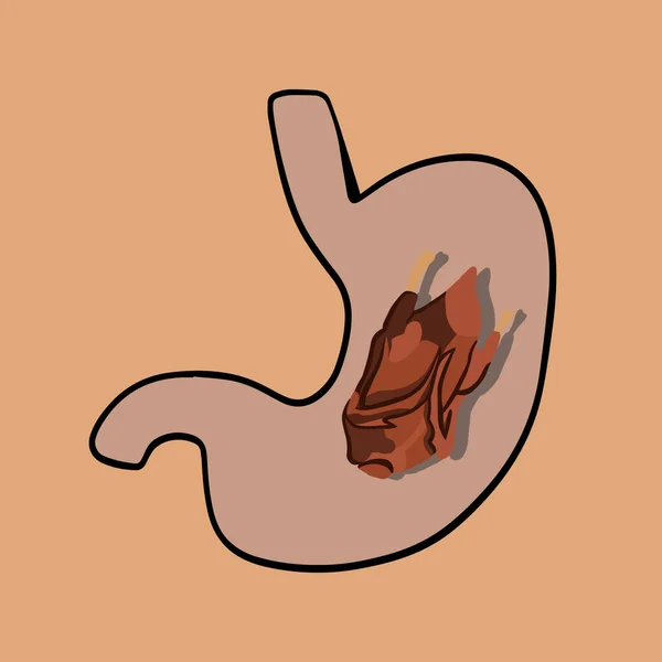 Ilustração Isolada Vetorial Digestão Carne Comer Demais Nas Férias Digestão — Vetor de Stock