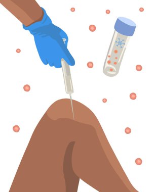 Kök hücre tedavisinin izole edilmiş vektör çizimi. Test tüpündeki kök hücreler. Kök hücreler dizlerine enjekte edilir..