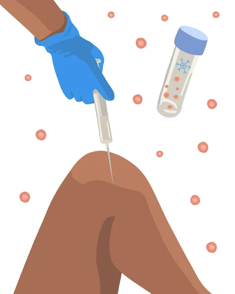 Vector Isolated Illustration Stem Cell Treatment Stem Cells Test Tube — Stock Vector