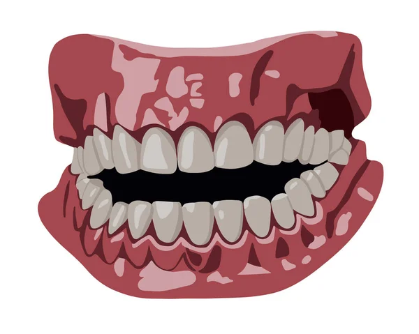 Wektor Odizolowany Ilustracja Ludzkiej Szczęki Zębami Dentysta Leczenie Zębów Wybielanie — Wektor stockowy