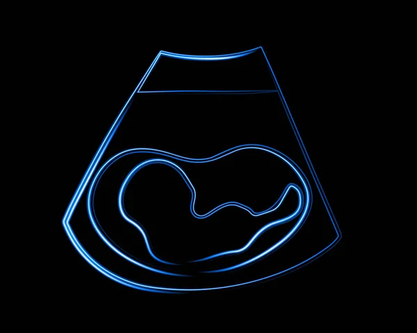 Vektorově Izolovaná Ilustrace Raného Embryonálního Sonogramu Neonovým Efektem — Stockový vektor
