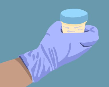 Sperm analizinin izole edilmiş temsilcisi. Sperm bağışı.