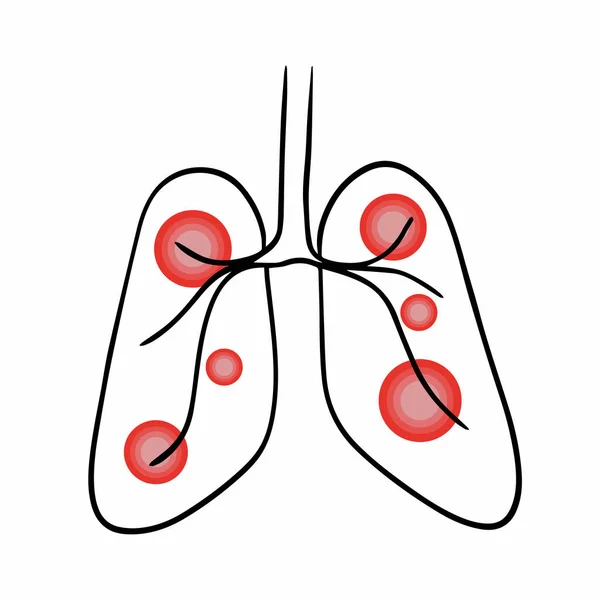 Wektor Izolowane Ilustracji Chorób Płuc Rysunek Konturu Płuc — Wektor stockowy