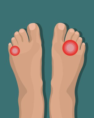 İnsan bacaklarının izole edilmiş yansıması. Ayak hijyeni ve bakımı.