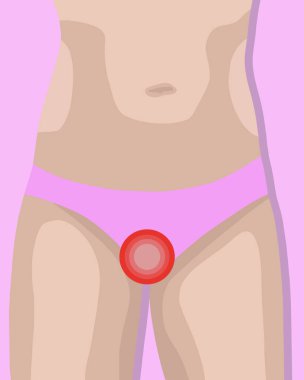 Kadın sağlığının izole edilmiş bir temsilcisi. Adet sırasında hijyen. Özel hijyen..