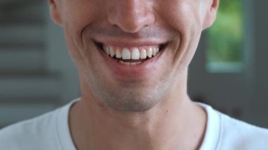 Delikanlının alt yüzünü kapat, kameranın önünde gülümse, dişlerini göster. Mutlu adam gülümsüyor, dişçi kliniğinde diş tedavisinden memnun kalan sağlıklı dişler gösteriyor..