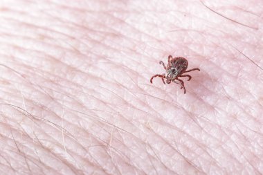 Yetişkin dişi kenesi - Ixodes ricinus. Yırtıcı bir parazit insan vücudu boyunca sürünür. Ensefalit veya Lyme borreliosis gibi bulaşıcı hastalıkların taşıyıcısı..
