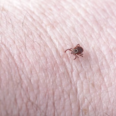 Yetişkin dişi kenesi - Ixodes ricinus. Yırtıcı bir parazit insan vücudu boyunca sürünür. Ensefalit veya Lyme borreliosis gibi bulaşıcı hastalıkların taşıyıcısı..