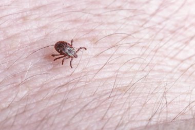 Yetişkin dişi kenesi - Ixodes ricinus. Yırtıcı bir parazit insan vücudu boyunca sürünür. Ensefalit veya Lyme borreliosis gibi bulaşıcı hastalıkların taşıyıcısı..