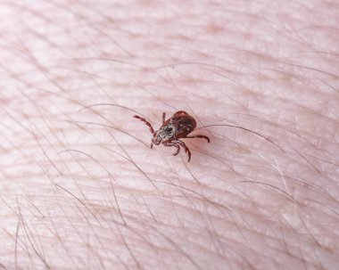 Adult female tick - Ixodes ricinus.A predatory parasitic tick crawls along the human body.Carrier of infectious diseases as encephalitis or Lyme borreliosis. clipart