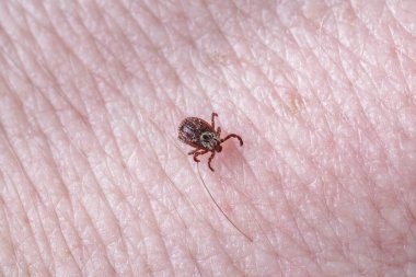 Yetişkin dişi kenesi - Ixodes ricinus. Yırtıcı bir parazit insan vücudu boyunca sürünür. Ensefalit veya Lyme borreliosis gibi bulaşıcı hastalıkların taşıyıcısı..