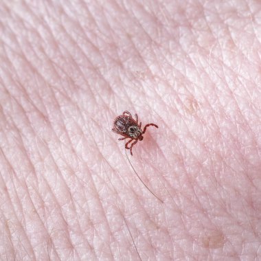 Yetişkin dişi kenesi - Ixodes ricinus. Yırtıcı bir parazit insan vücudu boyunca sürünür. Ensefalit veya Lyme borreliosis gibi bulaşıcı hastalıkların taşıyıcısı..