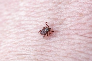 Yetişkin dişi kenesi - Ixodes ricinus. Yırtıcı bir parazit insan vücudu boyunca sürünür. Ensefalit veya Lyme borreliosis gibi bulaşıcı hastalıkların taşıyıcısı..