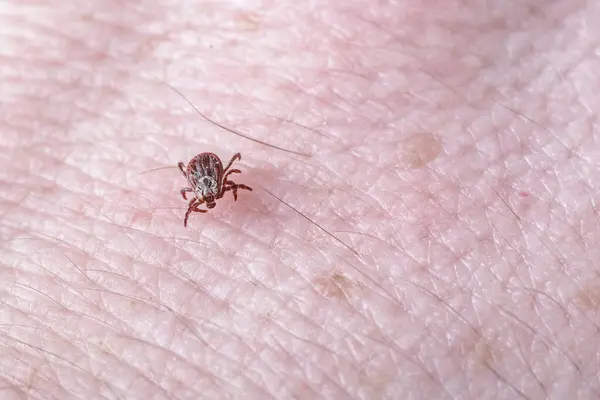 Stock image Adult female tick - Ixodes ricinus.A predatory parasitic tick crawls along the human body.Carrier of infectious diseases as encephalitis or Lyme borreliosis.