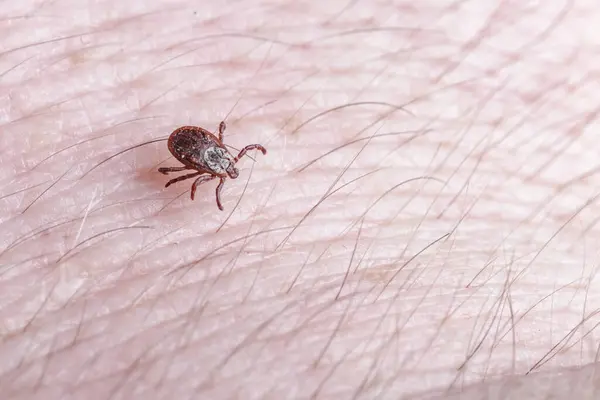 Stock image Adult female tick - Ixodes ricinus.A predatory parasitic tick crawls along the human body.Carrier of infectious diseases as encephalitis or Lyme borreliosis.