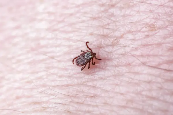 stock image Adult female tick - Ixodes ricinus.A predatory parasitic tick crawls along the human body.Carrier of infectious diseases as encephalitis or Lyme borreliosis.