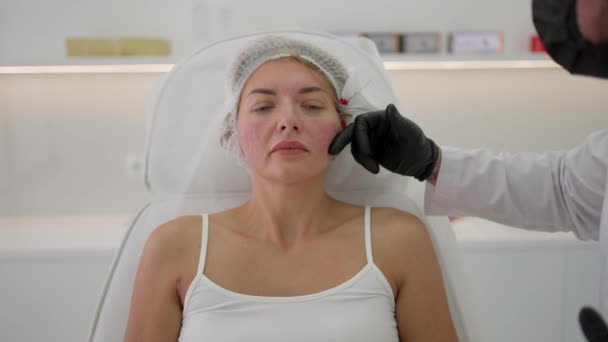 医者は医療用スレッド 化粧品療法の助けを借りて女性のための顔を作る — ストック動画