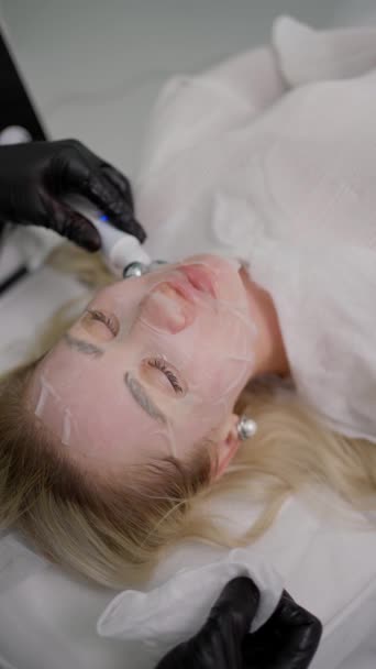 Kvinna Genomgår Kollagen Stimulering Förfarande Ansiktet Med Hjälp Kosmetisk Anordning — Stockvideo