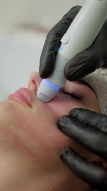 Wykwalifikowany Kosmetolog Wykonuje Zabieg Złuszczania Skóry Bazie Włókna Węglowego Kosmetolog — Wideo stockowe