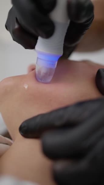 一位护肤专业人员以专家的精准程度 将一种治疗设备应用于病人的面部 这证明了面部手术的复杂性 — 图库视频影像