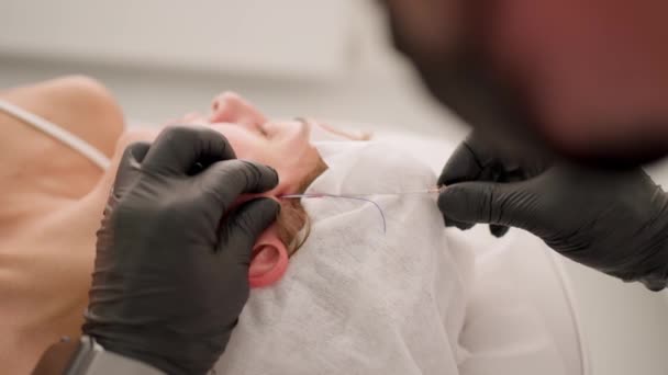 黑手套专家小心地将线插入病人的面部皮肤 病人躺在治疗台上 — 图库视频影像