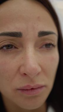 Kadının alnındaki kırışıklıklar, kozmetik dermatolojide yaygın bir sorundur..