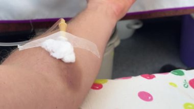 Koluna bant ve pamukla tutturulmuş damar içi kateter takılmış. Klinik sağlık ortamında damar yolu terapisi ya da kan bağışı yapıldığını gösteren tıbbi prosedür..