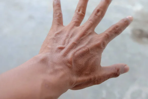 stock image Blood vessels in the skin of a man's hand. Closeup shot of male hand.