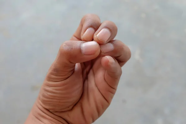 人の指の爪をぼやけた背景で閉じる 健康と医療の概念 — ストック写真