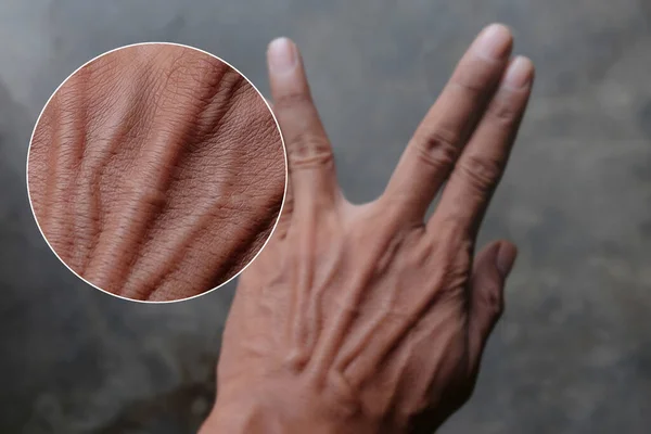 Bloedvaten Huid Van Iemands Hand Close Shot Van Mannelijke Hand — Stockfoto