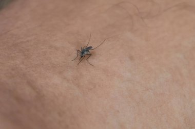 Aedes albopictus sivrisineği insan derisinin üzerine tünemiş. İnsan kanı emen sivrisinek.
